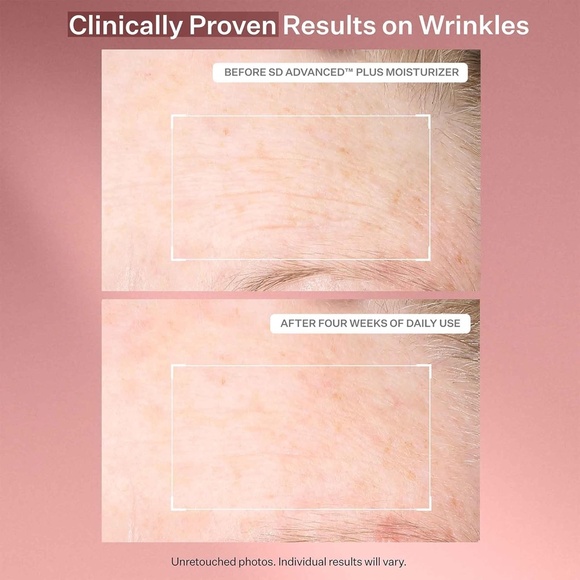 StriVectin SD Advanced Plus Intensive Moisturizer for Wrinkles and Stretch Marks - Picture 6 of 13